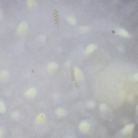 Spiral Diatoms on Nudibranch
